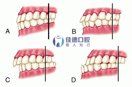 006gsAwDgy70jjeoh9e00&690_副本.jpg