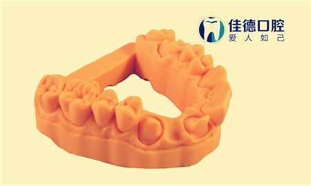 1409800860_3Dent_E-Denstone_3S_Peach_副本.png