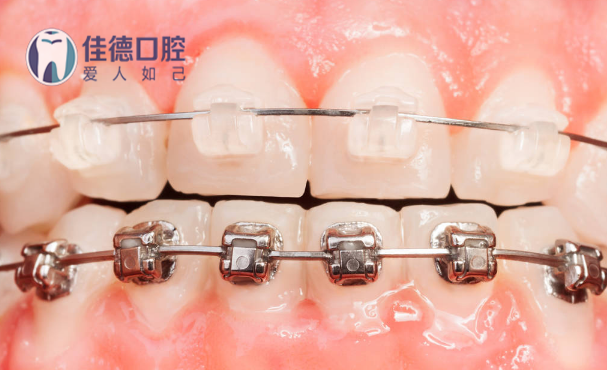 BFO}66RPQ[UL45%EJH@1TTB_副本.png
